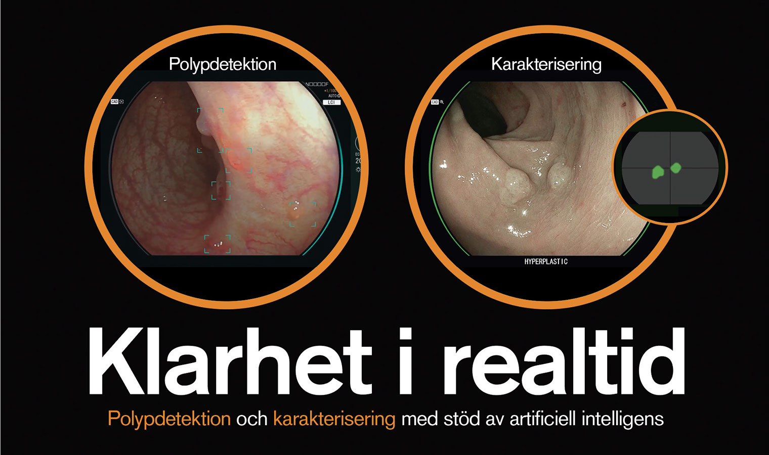 Gastroenterologi CAD-EYE